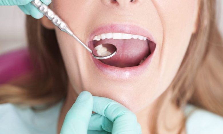 Root Canal Treatment - How It is Performed