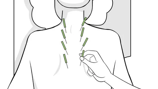 how -to-fix-a-crick-in-neck