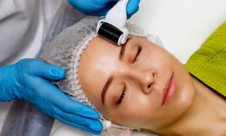 how much does microneedling cost