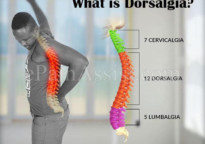 Posture-corrector-for-dorsalgia