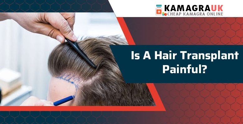 Is hair transplant painful